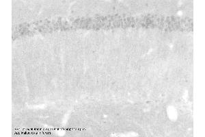 Immunohistochemistry with Small intestine tissue at an antibody concentration of 5µg/ml using anti-PSEN1 antibody (ARP58941_P050) (Presenilin 1 抗体  (Middle Region))