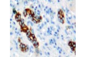 Used in DAB staining on fromalin fixed paraffin-embedded Liver tissue (NUMB 抗体  (AA 377-642))