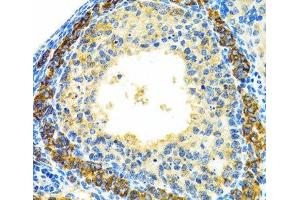 Immunohistochemistry of paraffin-embedded Rat ovary using MRPL28 Polyclonal Antibody at dilution of 1:100 (40x lens). (MRPL28 抗体)