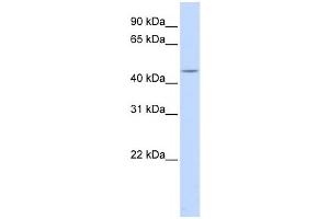 Western Blotting (WB) image for anti-Heat Shock Transcription Factor, Y-Linked 1 (HSFY1) antibody (ABIN2458437) (HSFY1 抗体)