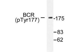 Image no. 1 for anti-Breakpoint Cluster Region (BCR) (pTyr177) antibody (ABIN317974) (BCR 抗体  (pTyr177))