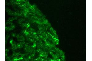 Image no. 2 for anti-Cardiotin antibody (ABIN335361) (Cardiotin 抗体)