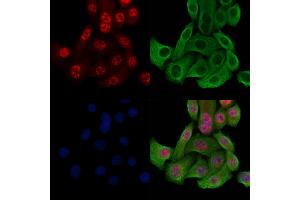 Phospho-Histone H3 (Thr3) Antibody staining Hela cells(heat shock treatment) by IF/ICC. (Histone 3 抗体  (H3T3ph))