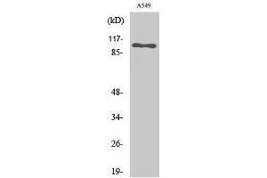 Western Blotting (WB) image for anti-Sodium Potassium ATPase, alpha1 (ATP1A1) (Ser16) antibody (ABIN3176206) (ATP1A1 抗体  (Ser16))