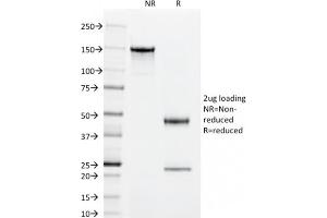 SDS-PAGE Analysis Purified CD55 Mouse Monoclonal Antibody (143-30). (CD55 抗体)