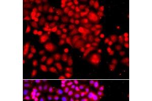 Immunofluorescence analysis of A549 cells using ASCC3 Polyclonal Antibody (ASCC3 抗体)