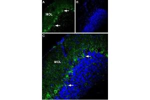 Expression of P2X1 Receptor in mouse cerebellum - Immunohistochemical staining of mouse cerebellum using Anti-P2X1 Receptor (extracellular) Antibody (ABIN7043571, ABIN7045096 and ABIN7045097). (P2RX1 抗体  (Extracellular Loop))