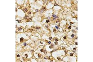 Immunohistochemical analysis of HUS1 staining in human kidney formalin fixed paraffin embedded tissue section. (HUS1 抗体)