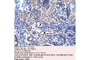 Human kidney (TAF1 抗体  (C-Term))