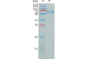 Human CD147 Protein, hFc Tag on SDS-PAGE under reducing condition.