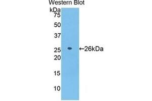 Detection of Recombinant AZU1, Human using Polyclonal Antibody to Azurocidin (AZU) (Azurocidin 抗体  (AA 23-247))