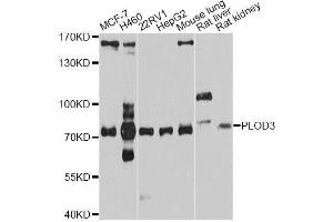 Western blot analysis of extracts of various cell lines, using PLOD3 antibody (ABIN5998540) at 1/1000 dilution. (PLOD3 抗体)