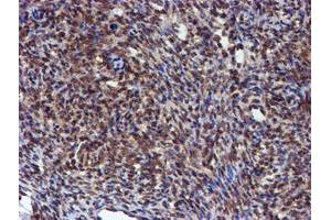 Image no. 10 for anti-Histidyl-tRNA Synthetase 2, Mitochondrial (Putative) (HARS2) antibody (ABIN1498584)