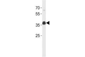 ER antibody (isoform 4) western blot analysis in SK-BR-3 lysate.