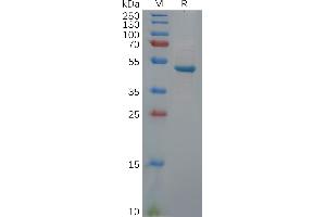 SDS-PAGE (SDS) image for Ubiquitin Carboxyl-terminal Esterase L1 (Ubiquitin Thiolesterase) (UCHL1) protein (Fc Tag) (ABIN7092785)