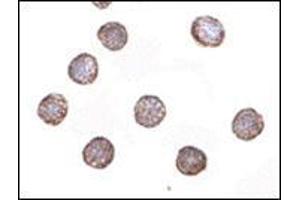 Immunocytochemistry of RNAse H2A in HeLa cells with this product at 2 μg/ml. (RNASEH2A 抗体  (Center))