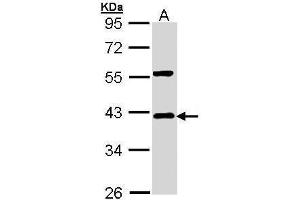 Western Blotting (WB) image for anti-Nuclear Factor of kappa Light Polypeptide Gene Enhancer in B-Cells Inhibitor, alpha (NFKBIA) (Center) antibody (ABIN2856763)
