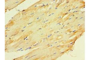 Immunohistochemistry of paraffin-embedded human skeletal muscle tissue using ABIN7148666 at dilution of 1:100 (CKMT2 抗体  (AA 40-230))