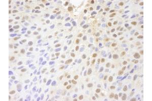 Immunohistochemistry (IHC) image for anti-Poly (ADP-Ribose) Polymerase Family, Member 10 (PARP10) (AA 300-350) antibody (ABIN7448715)