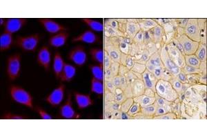 Image no. 2 for anti-Platelet Derived Growth Factor Receptor alpha (PDGFRA) (Tyr754) antibody (ABIN359914) (PDGFRA 抗体  (Tyr754))
