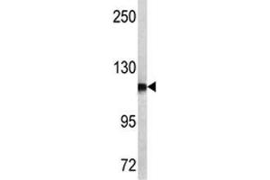 Western blot analysis of NPEPPS antibody and MCF-7 lysate. (NPEPPS 抗体  (AA 709-737))