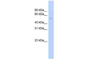 GAS8 antibody used at 1 ug/ml to detect target protein. (GAS8 抗体  (N-Term))