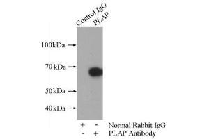 IP analysis of HepG2 cell lysates (1800 μg), using PLAP antibody (1/800 dilution). (PLAP 抗体)