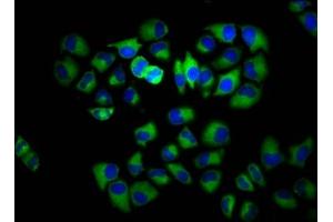 Immunofluorescence staining of Hela cells with ABIN7142862 at 1:133, counter-stained with DAPI. (INPP5E 抗体  (AA 1-133))