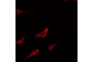 Immunofluorescence (fixed cells) (IF/ICC) image for anti-Mitogen-Activated Protein Kinase 8 (MAPK8) antibody (ABIN6262710)