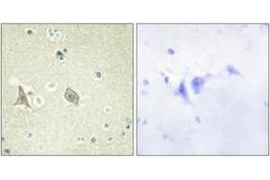 Immunohistochemistry analysis of paraffin-embedded human brain, using M-CSF Receptor (Phospho-Tyr723) Antibody. (CSF1R 抗体  (pTyr723))