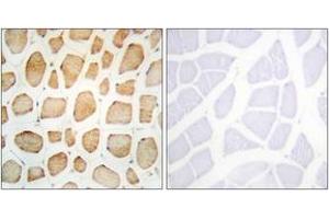 Immunohistochemistry analysis of paraffin-embedded human skeletal muscle tissue, using Actinin alpha-2/3 Antibody. (ACTN2/3 抗体  (AA 31-80))