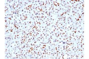 Formalin-fixed, paraffin-embedded human Pancreas stained with SOX9 Recombinant Rabbit Monoclonal Antibody (SOX9/3141R). (Recombinant SOX9 抗体  (AA 393-508))