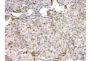 IHC analysis of GPX1 using anti GPX1 antibody (ABIN6719520).