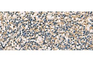 Immunohistochemistry of paraffin-embedded Human tonsil tissue using STX6 Polyclonal Antibody at dilution of 1:60(x200) (Syntaxin 6 抗体)