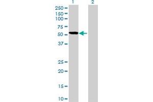 Western Blot analysis of PDLIM7 expression in transfected 293T cell line by PDLIM7 MaxPab polyclonal antibody. (PDLIM7 抗体  (AA 1-457))