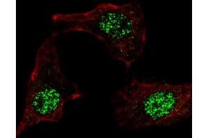 Fluorescent confocal image of HeLa cells stained with (ABIN389187 and ABIN2839350) KLF4 (N-term C74) antibody.