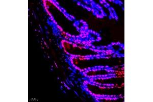 Immunofluorescence of paraffin embedded mouse colon using smad62024 (ABIN7075629) at dilution of 1:1000 (400x lens) (SMAD6 抗体)