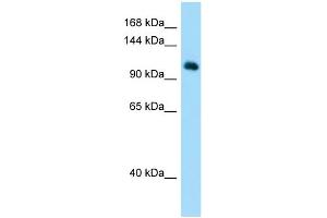 Host: Rabbit Target Name: MYSM1 Sample Type: Hela Whole Cell lysates Antibody Dilution: 1.