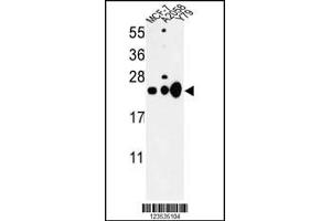 Western blot analysis of CBX1 Antibody in MCF-7, A2058, Y79 cell line lysates (35ug/lane) (CBX1 抗体  (C-Term))