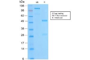 SDS-PAGE Analysis of Purified BCL2 Rabbit Recombinant Monoclonal Antibody ABIN6383843. (Recombinant Bcl-2 抗体)