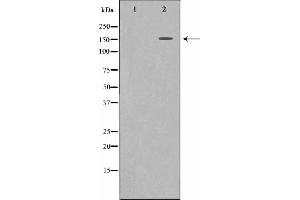 Western blot analysis of c-Met expression in HepG2 whole cell lysates,The lane on the left is treated with the antigen-specific peptide. (c-MET 抗体  (Internal Region))