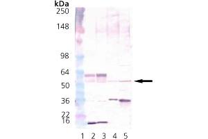 Western Blot Analysis of CaMKII: Lane 1: MWM, Lane 2: Brain (mouse), (tissue extract)  Lane 3:Brain (rat), (tissue extract)  Lane 4: HeLa, (cell lysate)  Lane 5: Hs-67 cell lysate. (CAMK2A 抗体  (N-Term))