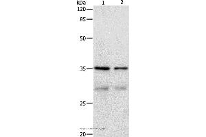 Western blot analysis of Hela and 293T cell, using CDK4 Polyclonal Antibody at dilution of 1:450 (CDK4 抗体)