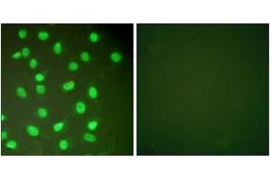 Immunofluorescence analysis of HepG2 cells, using MCM2 Antibody. (MCM2 抗体  (AA 1-50))