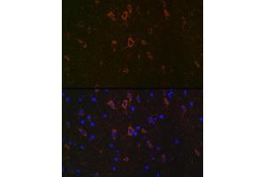 anti-Neurofilament, Heavy Polypeptide (NEFH) antibody