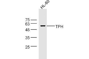 HL-60 cell lysates probed with Rabbit Anti-Trptophan Hydroxylase Polyclonal Antibody, Unconjugated  at 1:500 for 90 min at 37˚C. (Trptophan Hydroxylase (AA 31-150) 抗体)