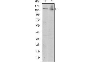 Western blot analysis using KIT mouse mAb against Jurkat (1) and Hela (2) cell lysate. (KIT 抗体)