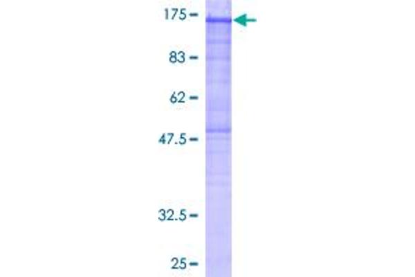PHKA2 Protein (AA 1-1235) (GST tag)