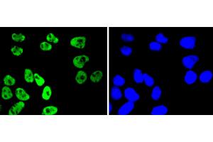 HeLa cells were stained with MSK1 (Ser376) (11A1) Monoclonal Antibody  at [1:200] incubated overnight at 4C, followed by secondary antibody incubation, DAPI staining of the nuclei and detection. (MSK1 抗体  (pSer376))
