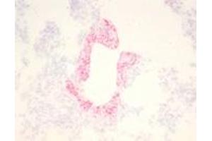 Immunohistochemical staining (Frozen Sections) of RSV-infected lung tissue (Guinea pig) (RSV 抗体)